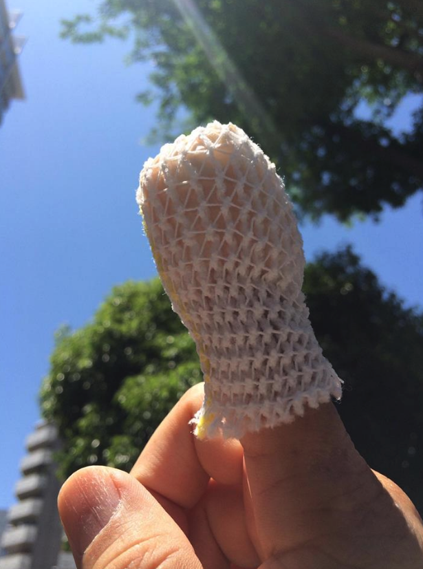 卓球人には大切な人差し指をまたもや